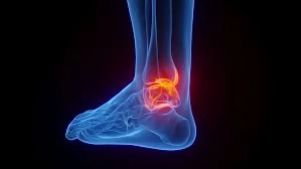 Understanding Posterior Ankle Pain 